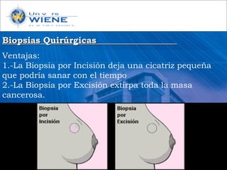 Biopsias QuirúrgicasBiopsias Quirúrgicas
Ventajas:
1.-La Biopsia por Incisión deja una cicatriz pequeña
que podría sanar con el tiempo
2.-La Biopsia por Excisión extirpa toda la masa
cancerosa.
 