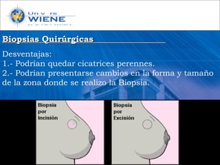 Biopsias QuirúrgicasBiopsias Quirúrgicas
Desventajas:
1.- Podrían quedar cicatrices perennes.
2.- Podrían presentarse cambios en la forma y tamaño
de la zona donde se realizo la Biopsia.
 