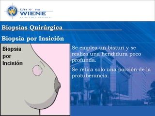 Biopsias QuirúrgicaBiopsias Quirúrgica
Biopsia por Insición
Se emplea un bisturí y se
realiza una hendidura poco
profunda.
Se retira solo una porción de la
protuberancia.
 
