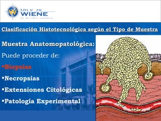 Muestra AnatomopatológicaMuestra Anatomopatológica:
Puede proceder de:
•Biopsias
•Necropsias
•Extensiones Citológicas
•Patología Experimental
Clasificación Histotecnológica según el Tipo de MuestraClasificación Histotecnológica según el Tipo de Muestra
 