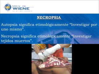 NECROPSIANECROPSIA
Autopsia significa etimológicamente “Investigar por
uno mismo”.
Necropsia significa etimológicamente “Investigar
tejidos muertos”.
 