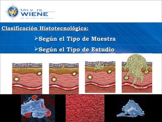 Clasificación Histotecnológica:Clasificación Histotecnológica:
Según el Tipo de MuestraSegún el Tipo de Muestra
Según el Tipo de EstudioSegún el Tipo de Estudio
 