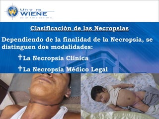 Clasificación de las NecropsiasClasificación de las Necropsias
Dependiendo de la finalidad de la Necropsia, se
distinguen dos modalidades:
La Necropsia Clínica
La Necropsia Médico Legal
 