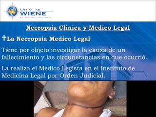 Necropsia Clínica y Medico LegalNecropsia Clínica y Medico Legal
La Necropsia Medico LegalLa Necropsia Medico Legal
Tiene por objeto investigar la causa de un
fallecimiento y las circunstancias en que ocurrió.
La realiza el Medico Legista en el Instituto de
Medicina Legal por Orden Judicial.
 
