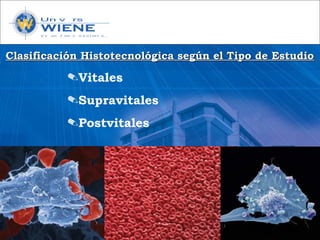 Clasificación Histotecnológica según el Tipo de EstudioClasificación Histotecnológica según el Tipo de Estudio
✎Vitales
✎Supravitales
✎Postvitales
 