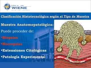 Muestra AnatomopatológicaMuestra Anatomopatológica:
Puede proceder de:
•Biopsias
•Necropsias
•Extensiones Citológicas
•Patología Experimental
Clasificación Histotecnológica según el Tipo de MuestraClasificación Histotecnológica según el Tipo de Muestra
 