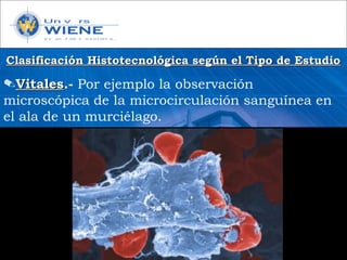 Clasificación Histotecnológica según el Tipo de EstudioClasificación Histotecnológica según el Tipo de Estudio
✎VitalesVitales.- Por ejemplo la observación
microscópica de la microcirculación sanguínea en
el ala de un murciélago.
 