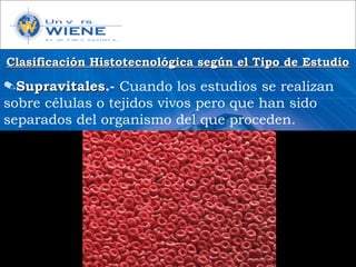 Clasificación Histotecnológica según el Tipo de EstudioClasificación Histotecnológica según el Tipo de Estudio
✎SupravitalesSupravitales.- Cuando los estudios se realizan
sobre células o tejidos vivos pero que han sido
separados del organismo del que proceden.
 