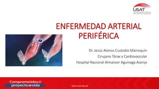 www.usat.edu.pe
Dr. Jesús Alonso Custodio Marroquín
Cirujano Tórax y Cardiovascular
Hospital Nacional Almanzor Aguinaga Asenjo
ENFERMEDAD ARTERIAL
PERIFÉRICA
 