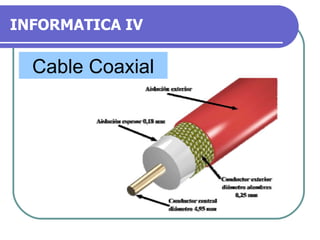 INFORMATICA IV Cable Coaxial 
