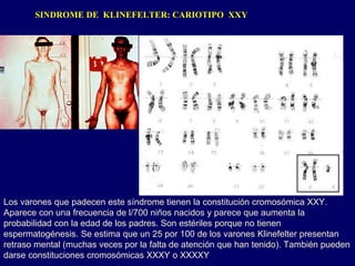 SINDROME DE KLINEFELTER: CARIOTIPO XXY
Los varones que padecen este síndrome tienen la constitución cromosómica XXY.
Aparece con una frecuencia de l/700 niños nacidos y parece que aumenta la
probabilidad con la edad de los padres. Son estériles porque no tienen
espermatogénesis. Se estima que un 25 por 100 de los varones Klinefelter presentan
retraso mental (muchas veces por la falta de atención que han tenido). También pueden
darse constituciones cromosómicas XXXY o XXXXY.
 