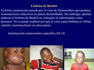 Linfoma de Burkitt
EnÁfrica central,está causado por el virus de Epstein-Barr, que produce
mononucleosis infecciosa en países desarrollados. Sin embargo, quienes
padecen el linfoma de Burkitt no contagian la enfermedad a otras
personas. No se puede explicar por qué el virus causa linfoma en África
central y mononucleosis en otros países.
translocación cromosomica específica t(8;14)
 