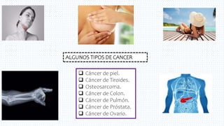 5
 Cáncer de piel.
 Cáncer de Tiroides.
 Osteosarcoma.
 Cáncer de Colon.
 Cáncer de Pulmón.
 Cáncer de Próstata.
 Cáncer de Ovario.
ALGUNOS TIPOS DE CANCER
 