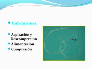 Indicaciones:
Aspiración y
Descompresión
Alimentación
Compresión
 