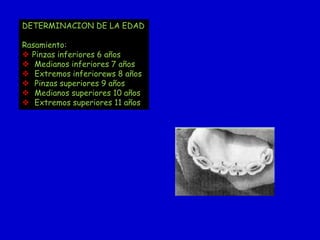 DETERMINACION DE LA EDAD
Rasamiento:
 Pinzas inferiores 6 años
 Medianos inferiores 7 años
 Extremos inferiorews 8 años
 Pinzas superiores 9 años
 Medianos superiores 10 años
 Extremos superiores 11 años

 