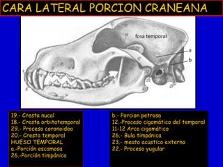 CARA LATERAL PORCION CRANEANA

19.- Cresta nucal
18.- Cresta orbitotemporal
29.- Proceso coronoideo
20.- Cresta temporal
HUESO TEMPORAL
a.-Porción escamosa
26.-Porción timpánica

b.- Porcion petrosa
12.-Proceso cigomático del temporal
11-12 Arco cigomático
26.- Bula timpánica
23.- meato acustico externo
22.- Proceso yugular

 