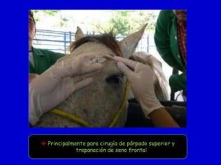  Principalmente para cirugía de párpado superior y
trepanación de seno frontal

 