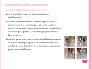 CUIDADOS DE LA SONDA NASOGASTRICA 
Cuidados del Estoma (lugar de entrada de la sonda): 
Antes de manipular la sonda hay que lavarse las manos 
cuidadosamente 
-Cura diaria durante tres semanas realizando limpieza suave de la 
zona alrededor de la sonda con agua y jabón, tras levantar el 
soporte externo, posteriormente secar bien la zona y colocar algún 
dispositivo( gasa, apósitos…) para evitar fugas periostomales si 
fuese necesario. 
-Comprobar que no existe excesiva compresión del dispositivo externo 
de sujeción sobre la piel y girarlo cuidadosamente a diario para 
distribuir las zonas de presión a la vez que evitamos una excesiva 
presión por parte del mismo. 
 