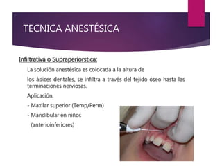 TECNICA ANESTÉSICA
Infiltrativa o Supraperiorstica:
La solución anestésica es colocada a la altura de
los ápices dentales, se infiltra a través del tejido óseo hasta las
terminaciones nerviosas.
Aplicación:
- Maxilar superior (Temp/Perm)
- Mandibular en niños
(anterioinferiores)
 