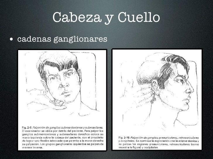 cadenas ganglionares de cabeza y cuello clase 2 cabeza y cuello cadenas ganglionares de cabeza y cuello clase 2 cabeza y cuello