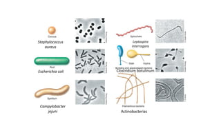 PARED CELULAR: MORFOLOGÍA BACTERIANA
Staphylococcus
aureus
Escherichia coli
Campylobacter
jejuni
Leptospira
interrogans
Clostridium botulinum
Actinobacterias
 