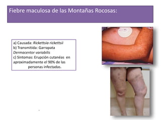 Clase 22 garrapatas- | PPTX