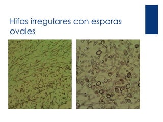Hifas irregulares con esporas
ovales
 
