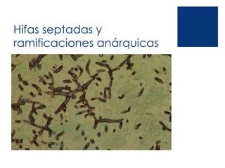 Hifas septadas y
ramificaciones anárquicas
 