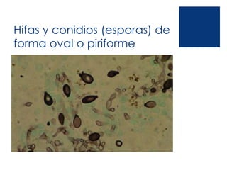 Hifas y conidios (esporas) de
forma oval o piriforme
 