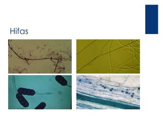 Hifas
 