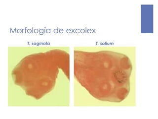 Morfología de excolex
T. saginata T. solium
 