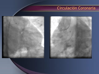 Circulación Coronaria
 