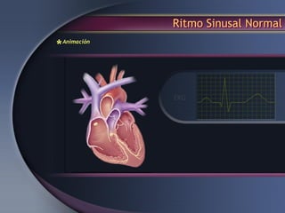 Ritmo Sinusal Normal
*Animación
 
