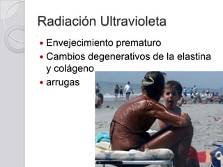 Radiación Ultravioleta
Envejecimiento prematuro
 Cambios degenerativos de la elastina
y colágeno
 arrugas


 