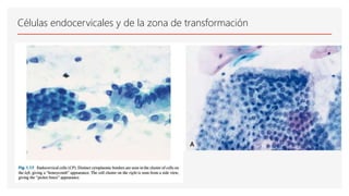 Células endocervicales y de la zona de transformación
 