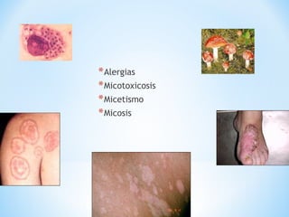 *Alergias
*Micotoxicosis
*Micetismo
*Micosis
 