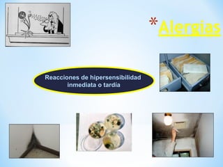 Reacciones de hipersensibilidad
inmediata o tardía
 