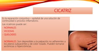 CICATRIZ
Es la reparación conjuntivo – epitelial de una solución de
continuidad o proceso inflamatorio.
Las cicatrices puede ser:
- NORMALES
- VICIOSAS
- QUELOIDES
- NORMALES: Son depresibles a la palpación no adherentes a
los planos subyacentes y de color rosado. Pueden tornarse
acrómicas o hipercrómicas.
 