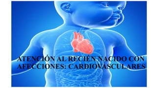 ATENCIÓN AL RECIÉN NACIDO CON
AFECCIONES: CARDIOVASCULARES
 