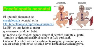 Encefalopatía neonatal
El tipo más frecuente de
encefalopatía neonatal es la
EHI (encefalopatía hipóxico-isquémica).
La EHI es una lesión al nacer
que ocurre cuando un bebé
no recibe suficiente oxígeno y sangre al cerebro durante el parto.
También se denomina asfixia natal o asfixia perinatal.
Cuando el cerebro no recibe suficiente oxígeno y sangre, puede
causar desde problemas de salud leves hasta discapacidad grave.
 