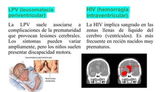 LPV (leucomalacia
periventricular)
La LPV suele asociarse a
complicaciones de la prematuridad
que provocan lesiones cerebrales.
Los síntomas pueden variar
ampliamente, pero los niños suelen
presentar discapacidad motora.
HIV (hemorragia
intraventricular)
La HIV implica sangrado en las
zonas llenas de líquido del
cerebro (ventrículos). Es más
frecuente en recién nacidos muy
prematuros.
 