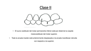 Clase II
• El surco vestibular del molar permanente inferior está por distal de la cúspide
mesiovestibular del molar superior.
• Toda la arcada maxilar está anteriormente desplazada o la arcada mandibular retruída
con respecto a la superior.
 
