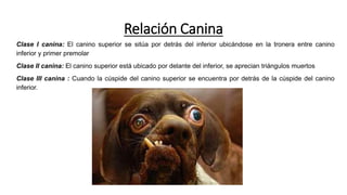 Relación Canina
Clase I canina: El canino superior se sitúa por detrás del inferior ubicándose en la tronera entre canino
inferior y primer premolar
Clase II canina: El canino superior está ubicado por delante del inferior, se aprecian triángulos muertos
Clase III canina : Cuando la cúspide del canino superior se encuentra por detrás de la cúspide del canino
inferior.
 