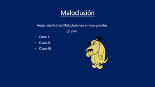 Maloclusión
Angle clasificó las Maloclusiones en tres grandes
grupos:
• Clase I.
• Clase II.
• Clase III.
 