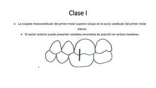 Clase I
La cúspide mesiovestibular del primer molar superior ocluye en el surco vestibular del primer molar
inferior.
El sector anterior puede presentar variables anomalías de posición en ambos maxilares.
 