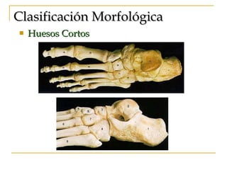 Clasificación Morfológica   Huesos Cortos 