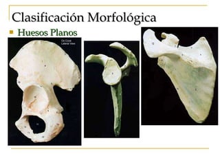Clasificación Morfológica   Huesos Planos 