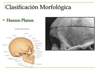 Clasificación Morfológica Huesos Planos 