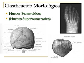 Clasificación Morfológica   Huesos Sesamoideos (Huesos Supernumerarios) 