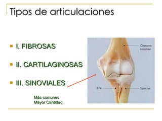 Tipos de articulaciones I. FIBROSAS II. CARTILAGINOSAS III. SINOVIALES Más comunes Mayor Cantidad 